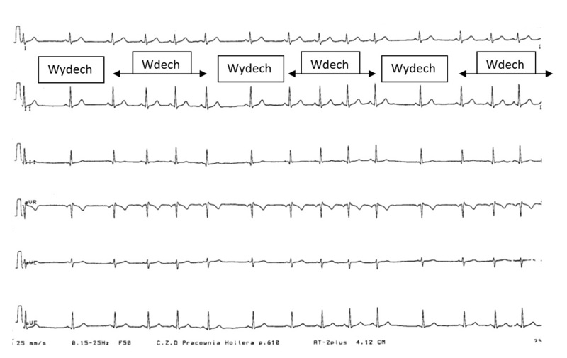 Medium brzezinska 02 ok opt
