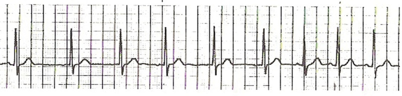 Medium brzezinska 03 opt