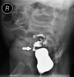 Small borek1 przed operacj%c4%85 opt