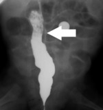 Small borek2 po operacji war opt