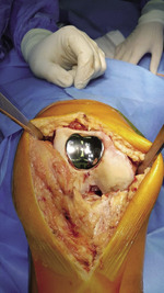 Small ryc 3 wave opt