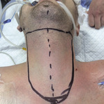 Small 3621315302 opt