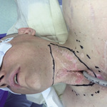 Small 3621321140 opt