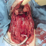 Small 3621322064 opt