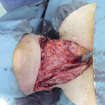 Small 3621322580 opt