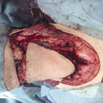 Small 3621322250 opt