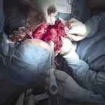 Small 3621324161 opt