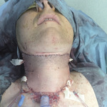 Small 3621324482 opt