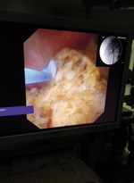 Small 20160121 163956 opt