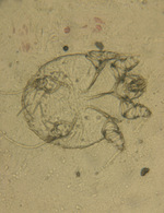 Small 1 swierzbowiec ludzki opt