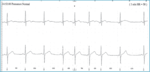Small ryc 2 1 fmt