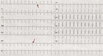 Small ryc 3 1 opt