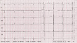 Small 3 opt