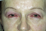 Small 1 photo24 13a opt