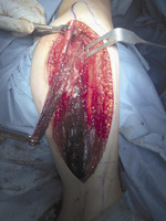 Small 3 kosc strzalkowa pobi opt