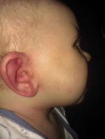 Small ryc 1 opt