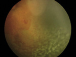 Small ryc 3 opt