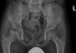 Small ryc 5 opt
