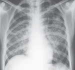 Small ryc 2 ong opt
