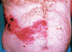 Small ryc 1 samp opt