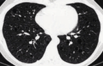 Small ryc 4 opt