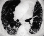 Small ryc 1 opt