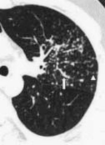 Small ryc 2 opt