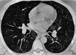 Small ryc 3 opt