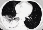 Small ryc 5 opt