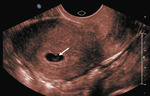 Small 1 opt